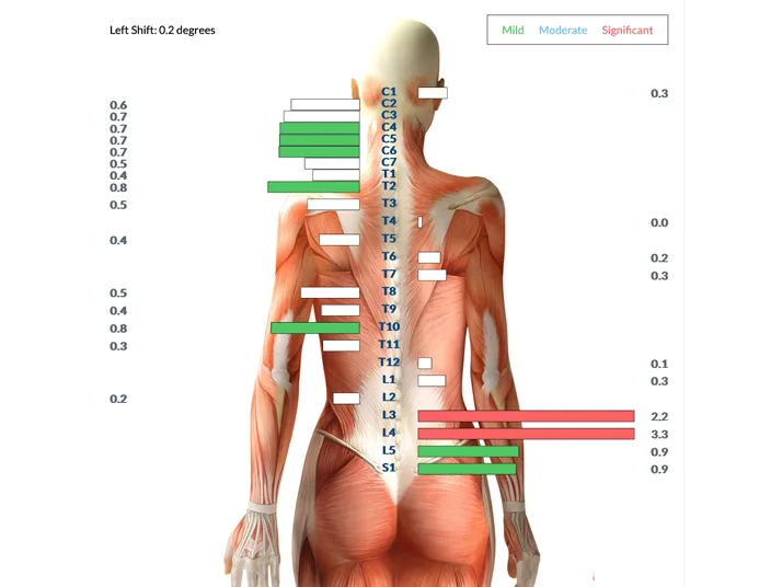 Chiropractic American Fork UT Example